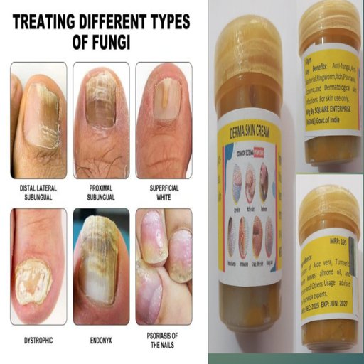 50gm Derma Skin Cream 