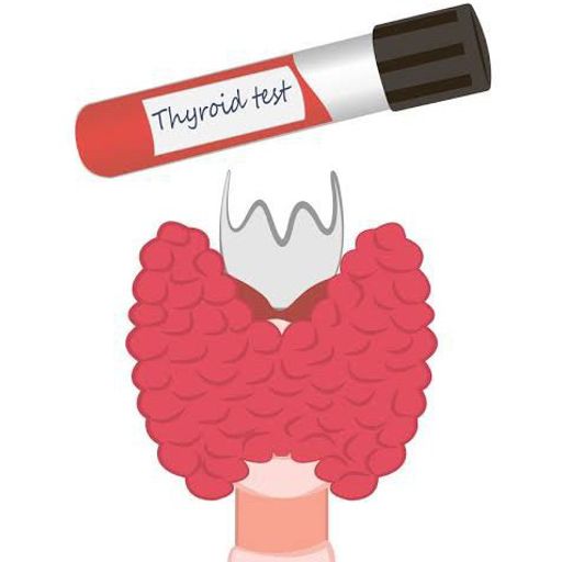 Thyroid Stimulating Hormone (TSH)
