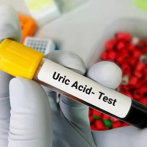 Uric Acid Test