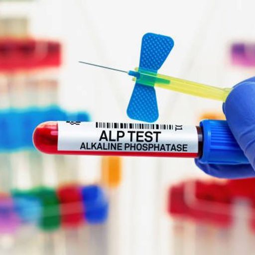 Alkaline Phosphatase Test
