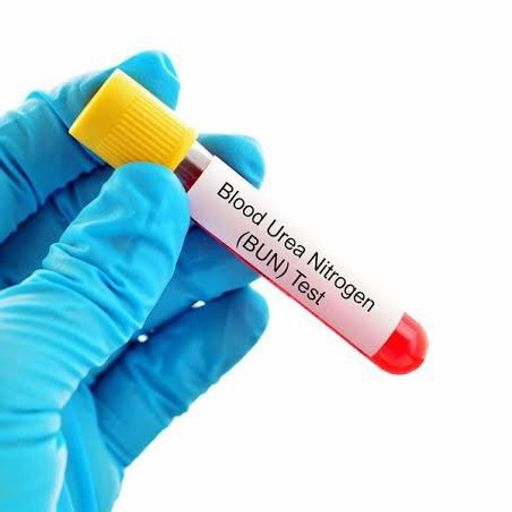 Blood Nitrogen Urea Test