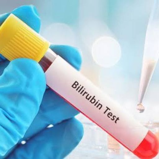 Bilirubin Test