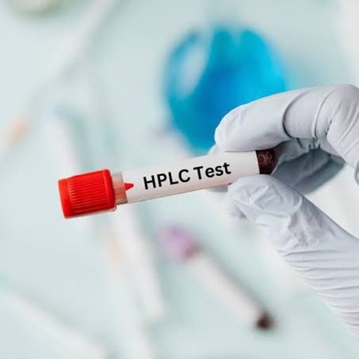 HPLC (High Performancr Liquid Chromatography)