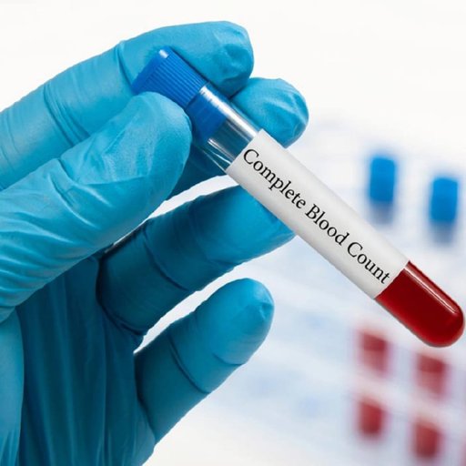 CBC ( Complete Blood Count)