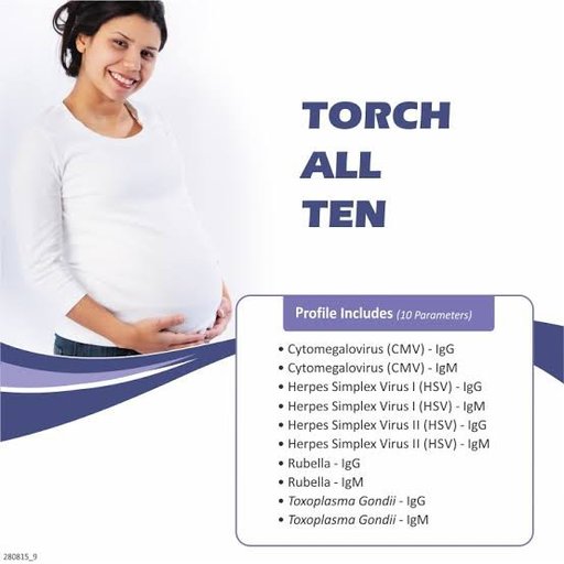 Torch All 10 Profile